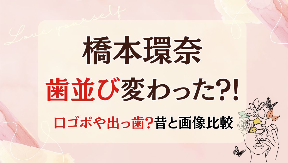 2025最新!橋本環奈の歯並び変わった?!口ゴボや出っ歯だった?昔と画像比較