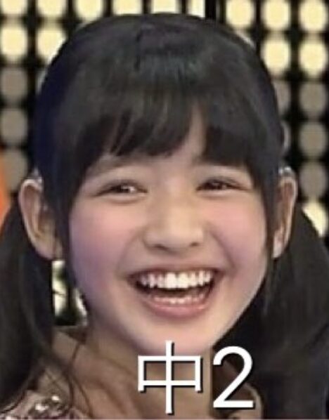 鎮西寿々歌　顔変わった　整形