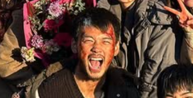 竹内涼真　歯並び変わった