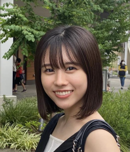 佐野愛花　顔変わった　整形
