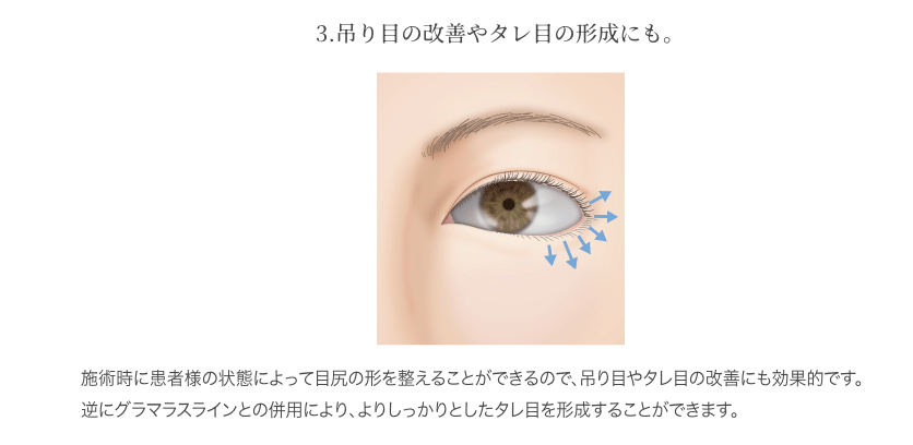 釈由美子　顔変わった　整形