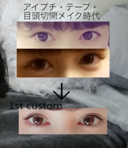 Rちゃん　整形前　昔の顔
