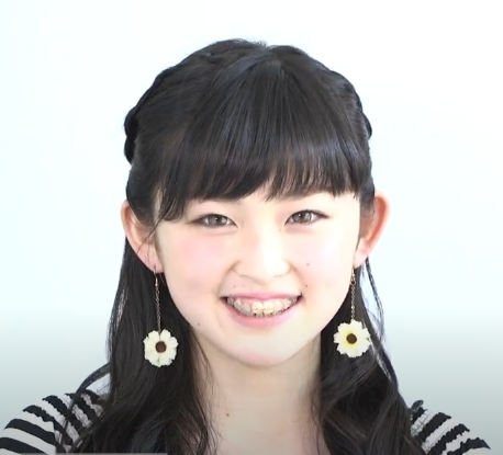 ゆうちゃみ　顔変わった　整形