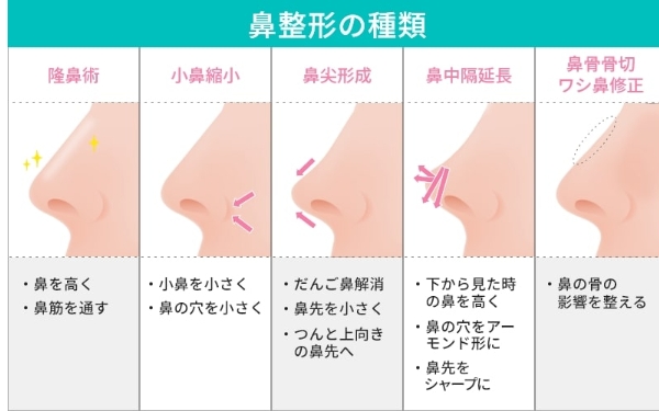 小川栞奈　整形　顔変わった