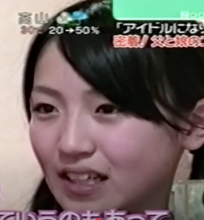 前島亜美　顔変わった　整形
