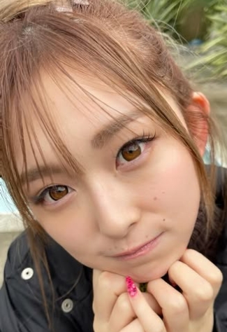 ゆうちゃみ　顔変わった　整形
