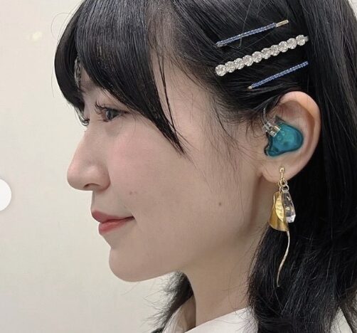 前島亜美　顔変わった　整形
