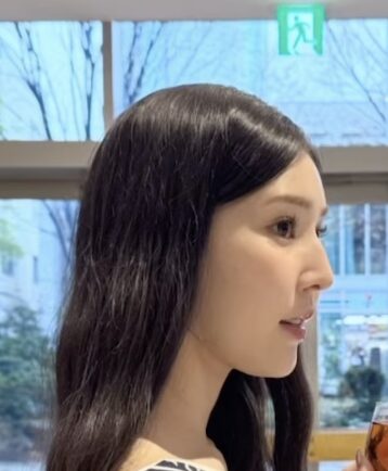 石森美月季　顔変わった　整形
