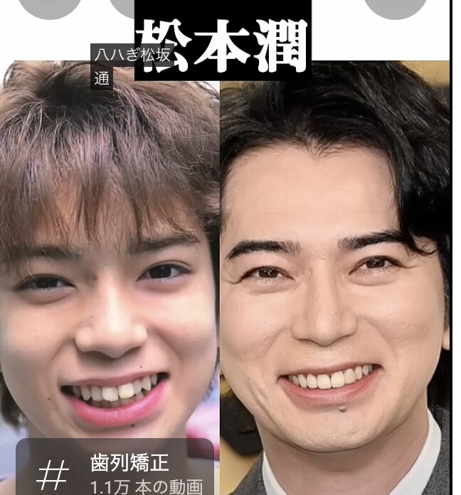 松本潤　顔変わった　整形