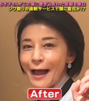 高嶋ちさ子　整形　顔変わった