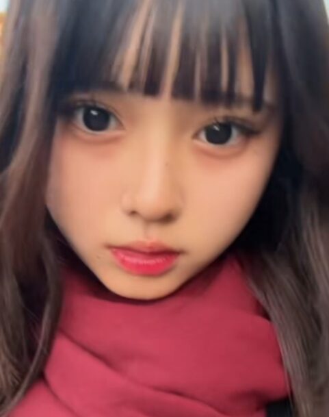 今日好き　ひな　整形