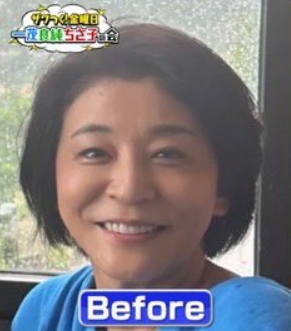 高嶋ちさ子　整形　顔変わった