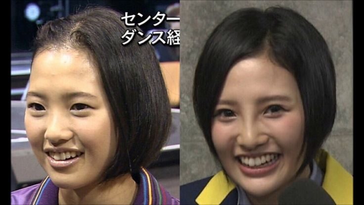 兒玉遥 整形前