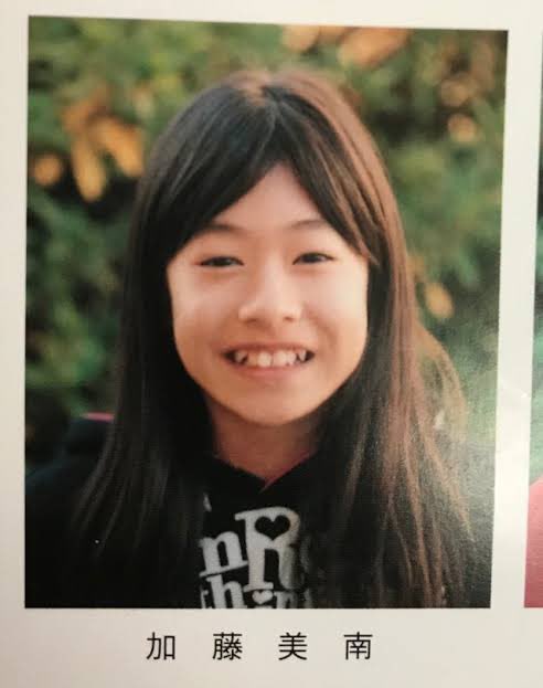 加藤美南　鼻整形