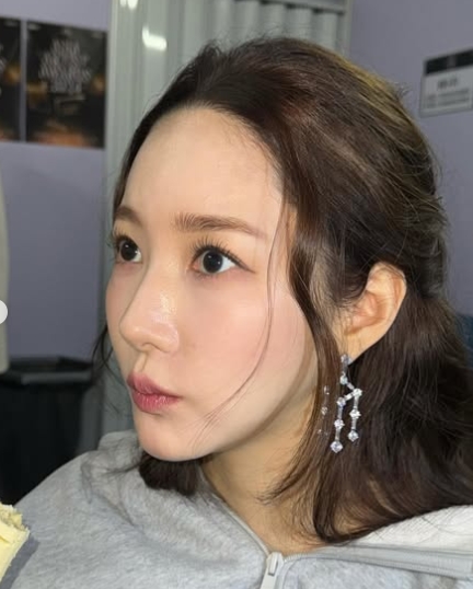パク・ミニョン　整形　顔が変わった