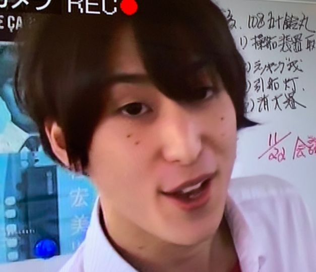 佐久間大介　整形　顔変わった