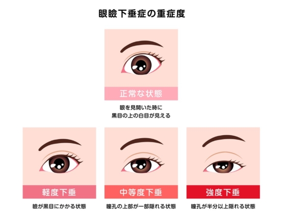 佐久間大介　整形　顔変わった