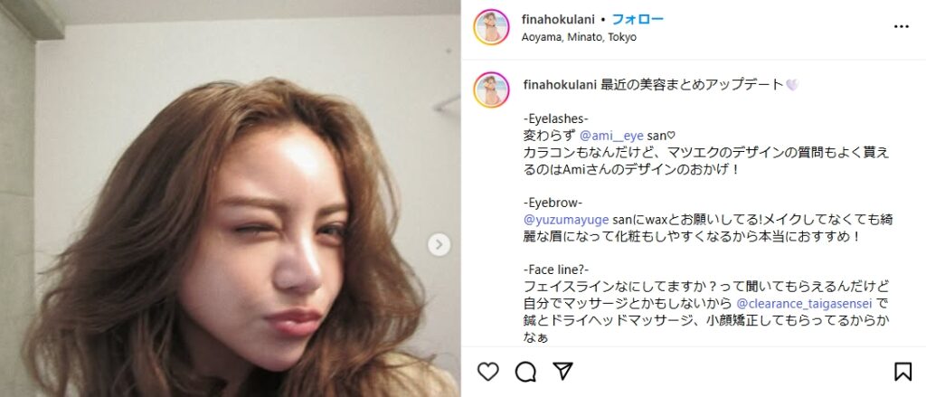 平瀬フィーナ　整形　顔変わった
