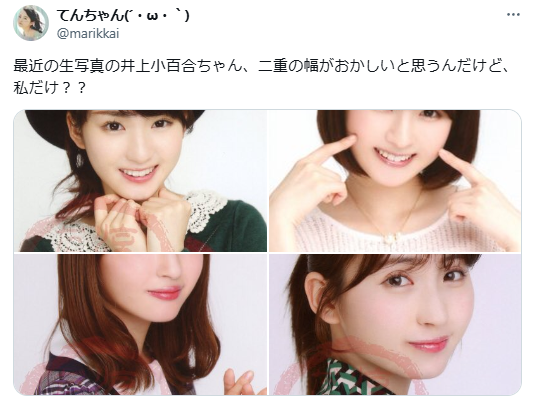井上小百合 顔変わった 整形