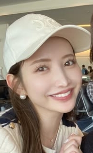 尾崎美紀　整形　顔変わった