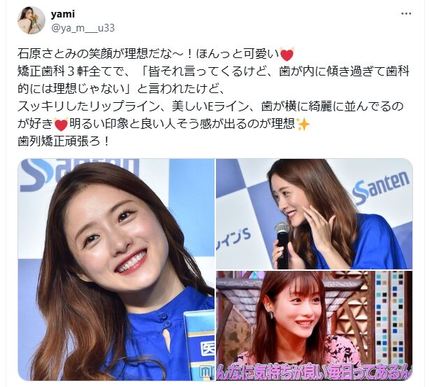 石原さとみ　歯並び