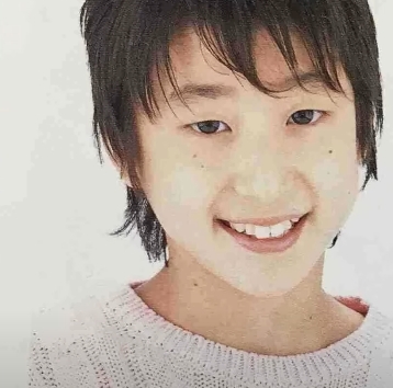 佐久間大介　整形　顔変わった