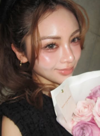 平瀬フィーナ　整形　顔変わった