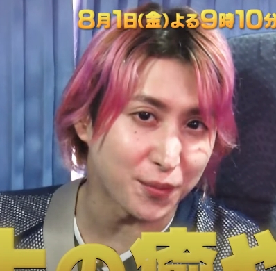 佐久間大介　整形　顔変わった
