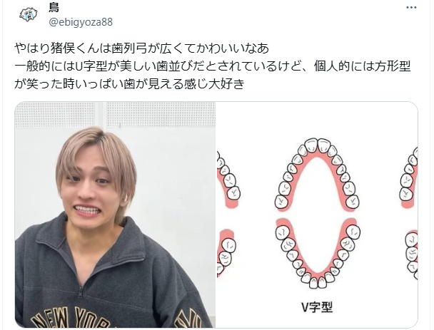 猪俣周杜 歯並び