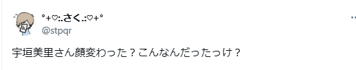 宇垣美里　顔変わった　整形