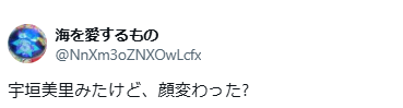 宇垣美里　顔変わった　整形