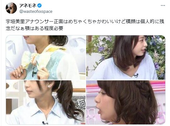 宇垣美里　顔変わった　整形