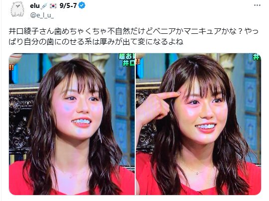 井口綾子 顔変わった 整形
