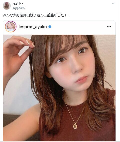 井口綾子 顔変わった 整形