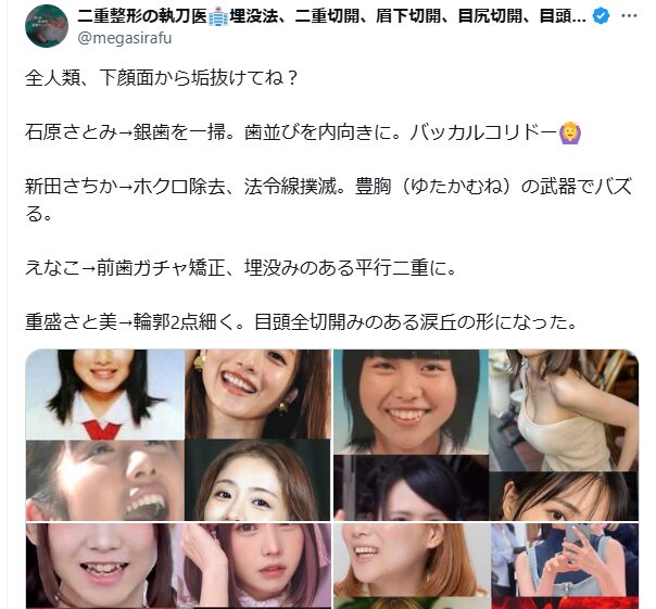 石原さとみ　歯並び