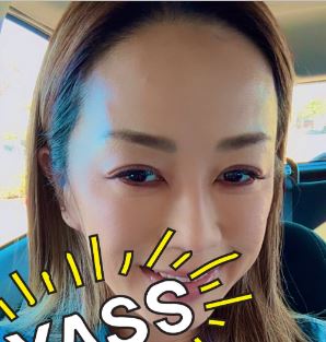 警察官ゆり 整形 顔変わった
