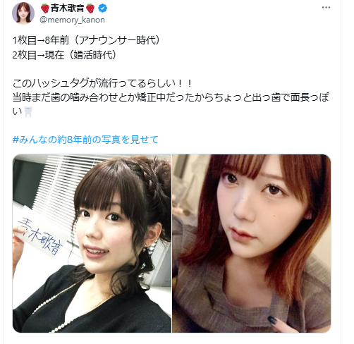 青木歌音 顏変わった 整形