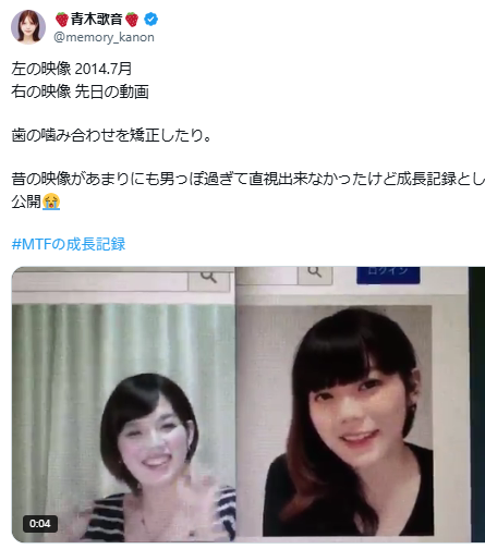 青木歌音 顏変わった 整形