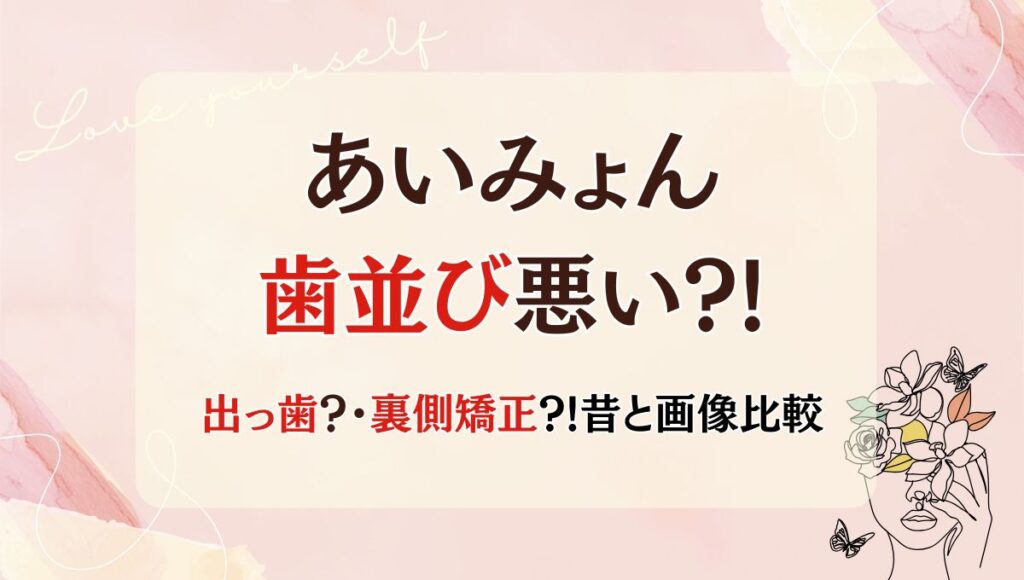 【画像】あいみょんの歯並び悪い?!出っ歯だった?裏側矯正した?昔画像と比較!