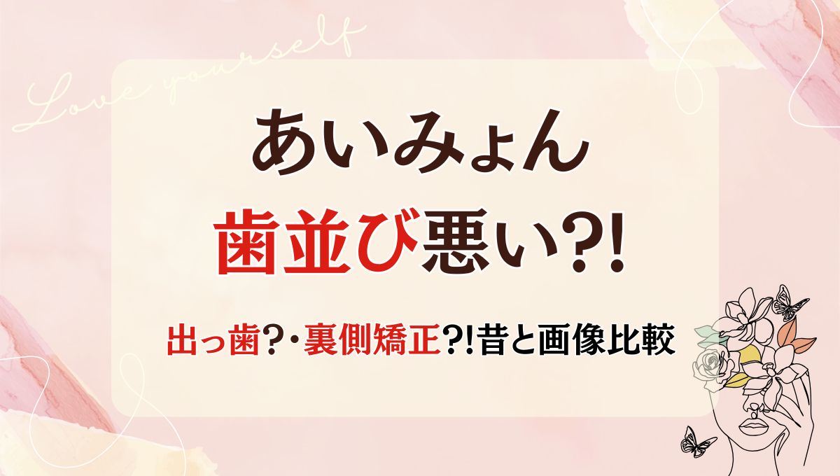 【画像】あいみょんの歯並び悪い?!出っ歯だった?裏側矯正した?昔画像と比較!