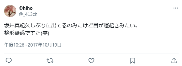 坂井真紀　整形　顔変わった