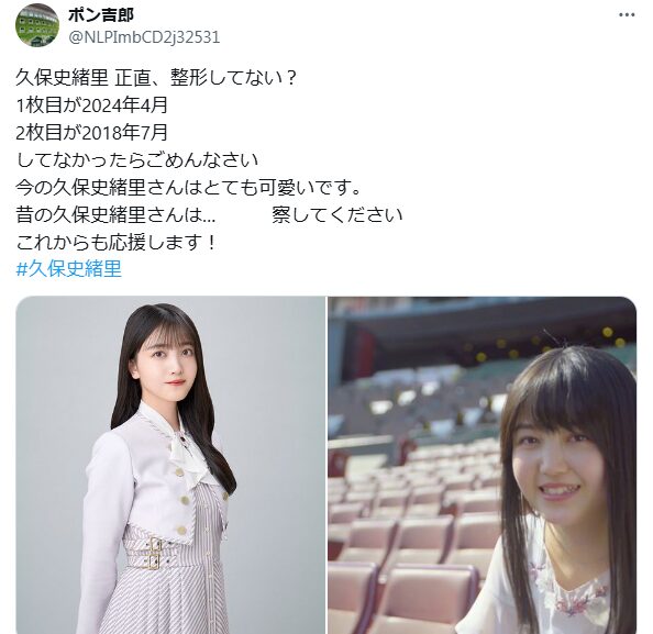 久保史緒里　整形　顔変わった