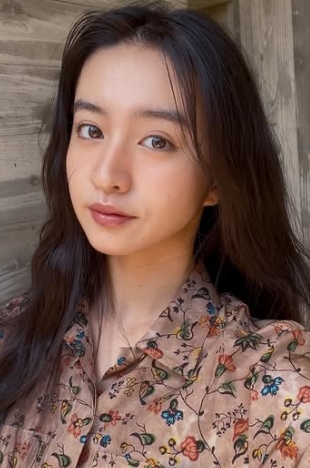 Koki　整形　顔変わった