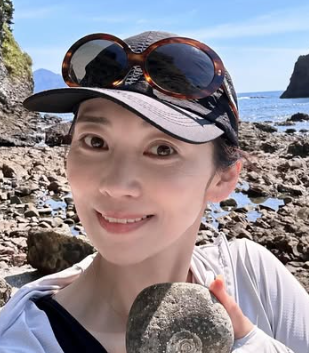 飯田圭織　顔変わった　整形