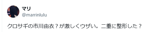 市川由衣 顔変わった 整形