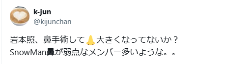 岩本照　顔変わった　整形