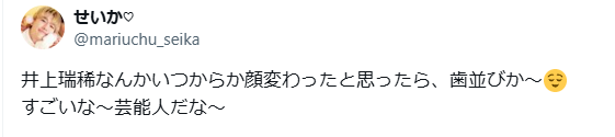 井上瑞稀　顔変わった　整形