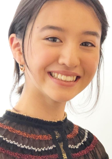 Koki　整形　顔変わった