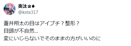 蒼井翔太 顏変わった 整形