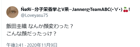 飯田圭織　顔変わった　整形